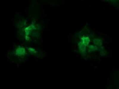 Immunocytochemistry/ Immunofluorescence: STK38L Antibody (OTI4D8) - Azide and BSA Free [NBP2-74403]