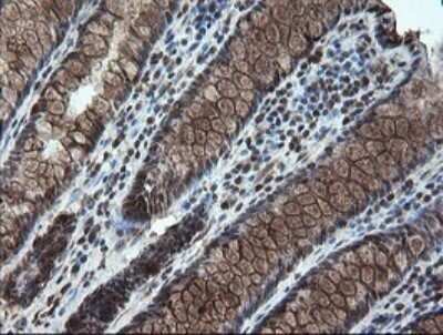 Immunohistochemistry: STK38L Antibody (OTI4D8) - Azide and BSA Free [NBP2-74403]