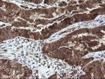 Immunohistochemistry: STK38L Antibody (OTI4D8) [NBP2-45983]