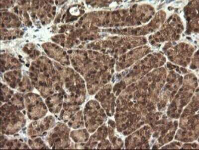 Immunohistochemistry: STK38L Antibody (OTI4D8) [NBP2-45983]