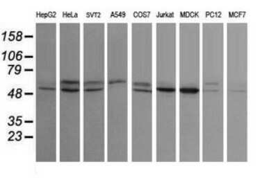 Western Blot: STK38L Antibody (OTI4D8) [NBP2-45983]