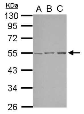 Western Blot: STK38L Antibody [NBP2-20518]