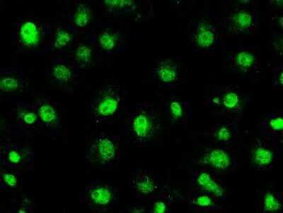 Immunocytochemistry/ Immunofluorescence: STK39 Antibody (OTI4E3) [NBP1-48021]