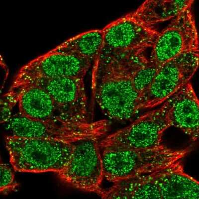 Immunocytochemistry/ Immunofluorescence: STK39 Antibody [NBP2-49347]