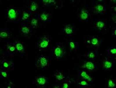 Immunocytochemistry/ Immunofluorescence: STK39 Antibody (OTI4E3) - Azide and BSA Free [NBP2-74406]