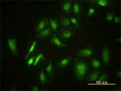 Immunocytochemistry/ Immunofluorescence: STK4 Antibody (1D7-8A10) [H00006789-M01]