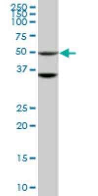 Western Blot: STK40 Antibody (4G3) [H00083931-M04]