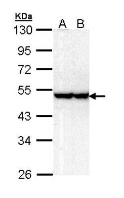 Western Blot: STK40 Antibody [NBP1-33391]