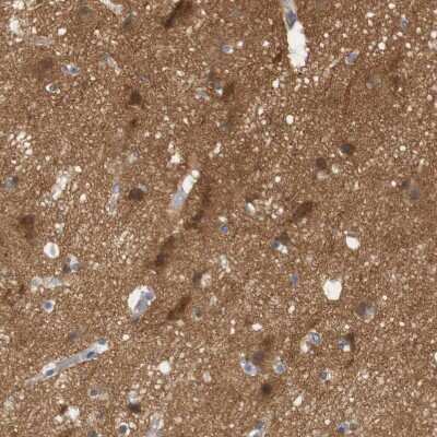 Immunohistochemistry-Paraffin: STMN3 Antibody [NBP1-80779]