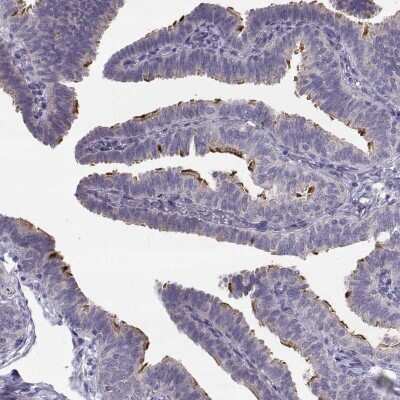 Immunohistochemistry-Paraffin: STMND1 Antibody [NBP2-57594]