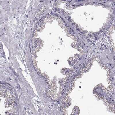 Immunohistochemistry-Paraffin: STMND1 Antibody [NBP2-57594]