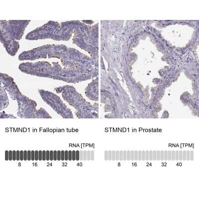 Immunohistochemistry-Paraffin: STMND1 Antibody [NBP2-57594]