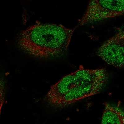 Immunocytochemistry/ Immunofluorescence: STOX1 Antibody [NBP1-90745]