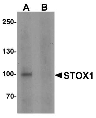 Western Blot: STOX1 AntibodyBSA Free [NBP2-82016]