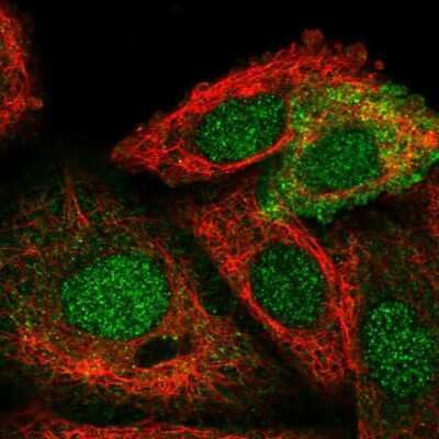 Immunocytochemistry/ Immunofluorescence: STRA6 Antibody [NBP1-83719]
