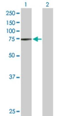 Western Blot: STRA6 Antibody [H00064220-D01P]