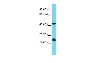 Western Blot: STRA8 Antibody [NBP2-84288]