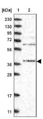 Western Blot: STRAP Antibody [NBP1-82796]