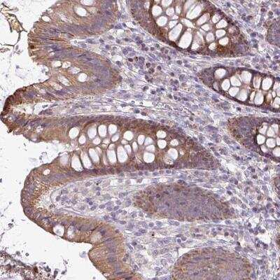 Immunohistochemistry-Paraffin: STRIP1 Antibody [NBP2-32528]