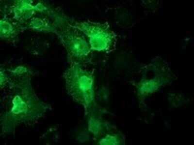 Immunocytochemistry/ Immunofluorescence: STRIP1 Antibody (OTI7B8) - Azide and BSA Free [NBP2-74408]