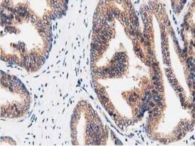 Immunohistochemistry: STRIP1 Antibody (OTI7B8) - Azide and BSA Free [NBP2-74408]