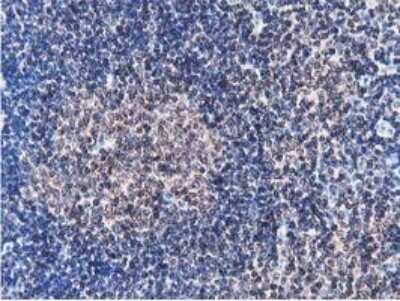 Immunohistochemistry: STRIP1 Antibody (OTI7B8) - Azide and BSA Free [NBP2-74408]