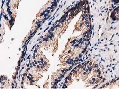 Immunohistochemistry: STRIP1 Antibody (OTI7B8) - Azide and BSA Free [NBP2-74408]