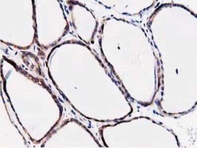Immunohistochemistry: STRIP1 Antibody (OTI7B8) - Azide and BSA Free [NBP2-74408]