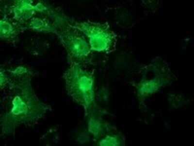 Immunocytochemistry/ Immunofluorescence: STRIP1 Antibody (OTI7B8) [NBP2-45715]