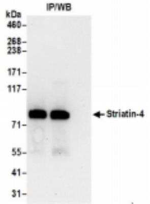 Immunoprecipitation: STRN4 Antibody [NBP2-36537]