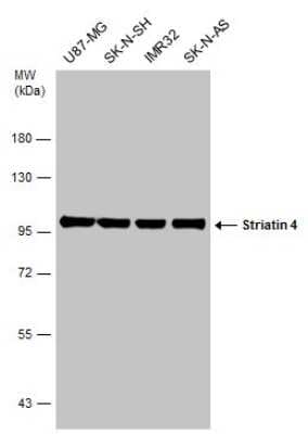 Western Blot: STRN4 Antibody [NBP3-13187]