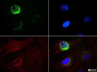 Immunocytochemistry/ Immunofluorescence: STRO-1 Antibody (STRO-1) - Azide and BSA Free [NBP2-80966]