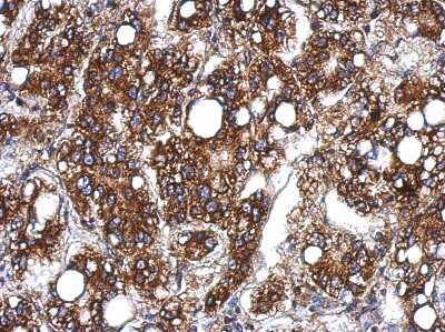 Immunohistochemistry-Paraffin: UBASH3B/STS1/Tula-2 Antibody [NBP2-20523]