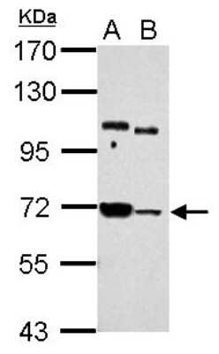 Western Blot: UBASH3B/STS1/Tula-2 Antibody [NBP2-20523]