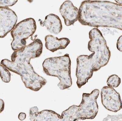 Immunohistochemistry-Paraffin: STT3A Antibody [NBP1-81576]