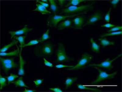 Immunocytochemistry/ Immunofluorescence: STX11 Antibody [H00008676-D01P]