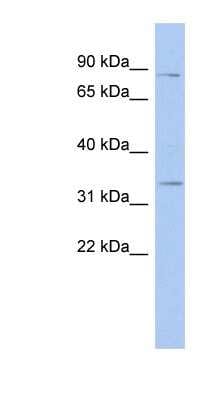 Western Blot: STX19 Antibody [NBP1-56467]