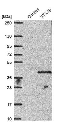 Western Blot: STX19 Antibody [NBP1-81172]