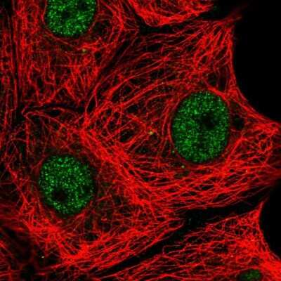 Immunocytochemistry/ Immunofluorescence: STYX Antibody [NBP1-92457]