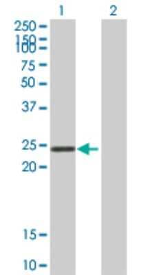 Western Blot: STYX Antibody [H00006815-B01P]