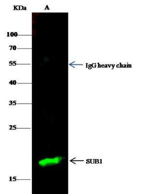 Immunoprecipitation: SUB1 Antibody (04) [NBP3-06541]