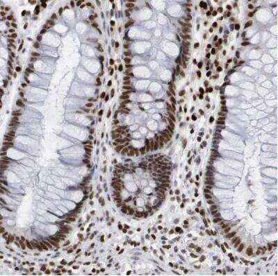 Immunohistochemistry-Paraffin: SUB1 Antibody [NBP1-82454]