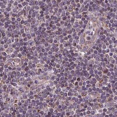 Immunohistochemistry-Paraffin: SUCLA2 Antibody [NBP2-56491]