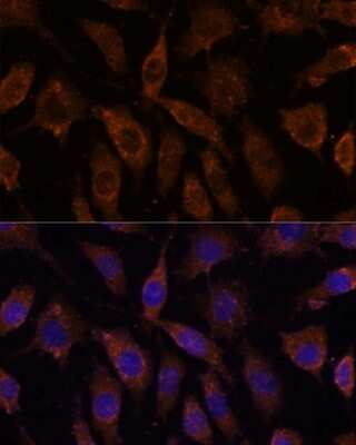 Immunocytochemistry/ Immunofluorescence: SUCLG1 Antibody - Azide and BSA Free [NBP2-93948]