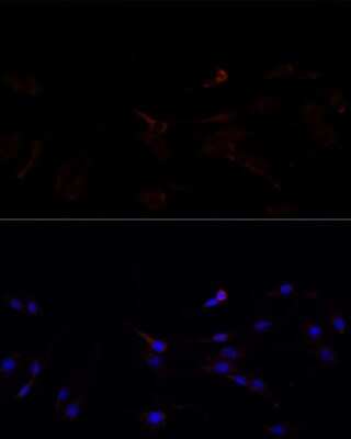 Immunocytochemistry/ Immunofluorescence: SUCLG1 Antibody - Azide and BSA Free [NBP2-93948]