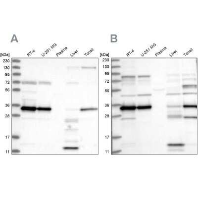 Western Blot: SUCLG1 Antibody [NBP2-38318]