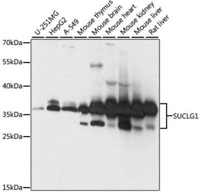 Western Blot: SUCLG1 AntibodyAzide and BSA Free [NBP2-93948]