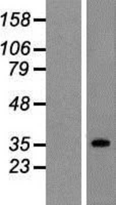 Western Blot: SUCLG1 Overexpression Lysate [NBP2-07943]