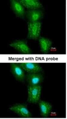 Immunocytochemistry/ Immunofluorescence: SUG1 Antibody [NBP1-33309]