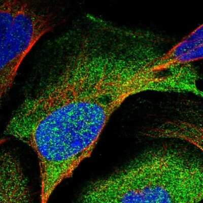 Immunocytochemistry/ Immunofluorescence: SUG1 Antibody [NBP1-87372]